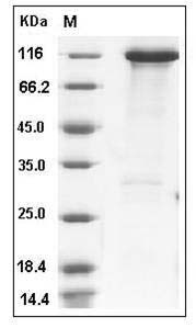 Human Hexokinase-3 / HK3 Protein (His & GST Tag) SDS-PAGE