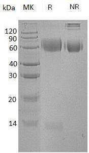 Human KNG1/BDK/KNG (His tag) recombinant protein