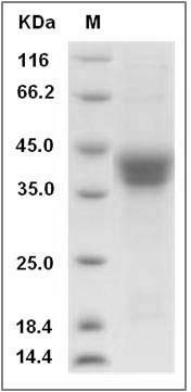 Rat CD157 / BST1 Protein (His Tag) SDS-PAGE