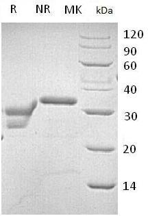 Human CTSL/CTSL1 (His tag) recombinant protein