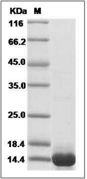Mouse S100A4 Protein (His Tag) SDS-PAGE