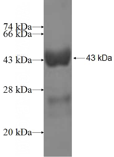Recombinant Human NME3 SDS-PAGE