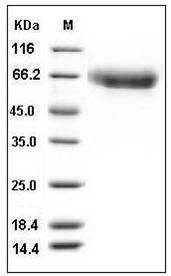 Influenza A H5N1 (A/Egypt/N05056/2009) Hemagglutinin / HA Protein (His Tag) SDS-PAGE