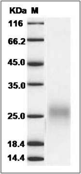 Human FLT3L / Flt3 ligand / FLT3LG Protein (His Tag) SDS-PAGE