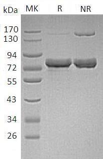 Human GLCE/KIAA0836 (Flag & His tag) recombinant protein