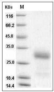 Mouse IGFBP6 / IBP-6 Protein (His Tag) SDS-PAGE