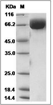 Cynomolgus EphA4 Protein (His Tag) SDS-PAGE