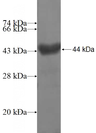 Recombinant Human SYT1 SDS-PAGE