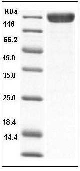 Human TrkC / NTRK3 Protein (His & Fc Tag) SDS-PAGE