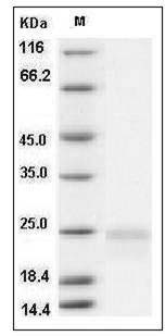 Rat VEGF164 / VEGFA Protein SDS-PAGE