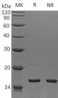 Human RPS19 recombinant protein