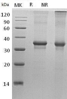 Human OTX2 (His tag) recombinant protein