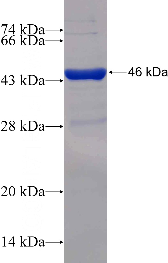 Recombinant Human Annexin IV SDS-PAGE