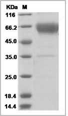 Rat BTLA Protein (Fc Tag) SDS-PAGE
