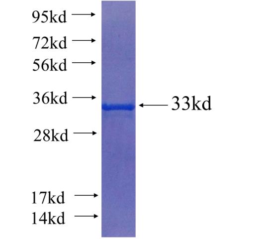 Recombinant human TRAF5 SDS-PAGE