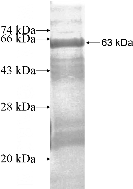 Recombinant Human C1orf222 SDS-PAGE