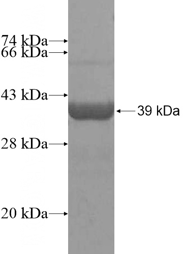 Recombinant Human DTNBP1a SDS-PAGE