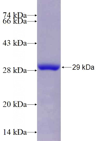 Recombinant Human LHPP SDS-PAGE