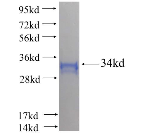 Recombinant human TRAM2 SDS-PAGE