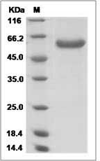 Human RAET1L / ULBP6 Protein (Fc Tag) SDS-PAGE