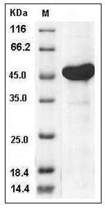 Human AK4 / Adenylate Kinase 4 / AK3L1 Protein (His & GST Tag) SDS-PAGE