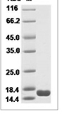 Human TNF-alpha/TNFA/TNFSF2 Protein 14104