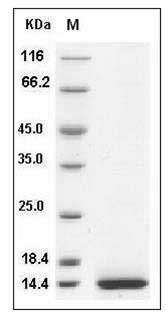 Human CCL11 Protein (His Tag) SDS-PAGE