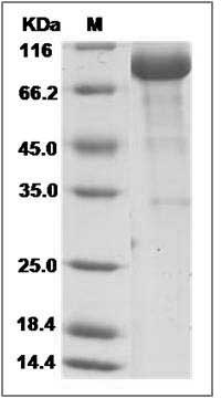 Human PRELP Protein (Fc Tag) SDS-PAGE