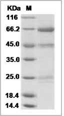 Influenza A H5N1 (A/chicken/Jilin/9/2004) Hemagglutinin / HA Protein (His Tag)