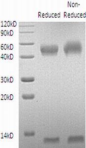 Mouse FcRn & B2M (His tag) recombinant protein