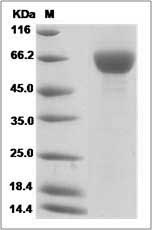 Cynomolgus / Rhesus FGFR3 / CD333 Protein (His Tag) SDS-PAGE