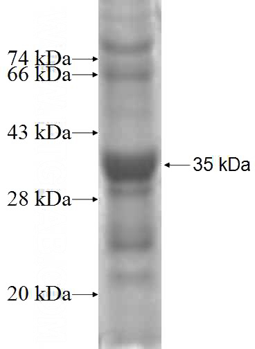 Recombinant Human FRG1 SDS-PAGE