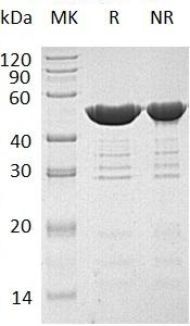 Human FEN1/RAD2 recombinant protein