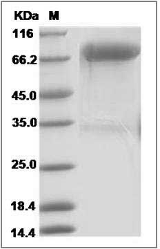 Human ROR1 Protein (Fc Tag) SDS-PAGE