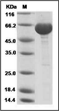 Human Leukotriene A4 Hydrolase / LTA4H Protein (His Tag) SDS-PAGE