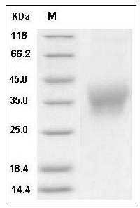 Human Ephrin-B2 / EFNB2 Protein (His Tag) SDS-PAGE