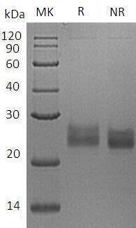 Human GFRA2/GDNFRB/RETL2/TRNR2 (His tag) recombinant protein