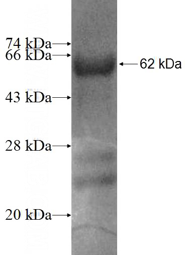 Recombinant Human STK17A SDS-PAGE
