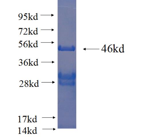 Recombinant human SUDS3 SDS-PAGE