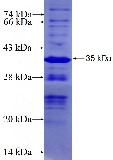Recombinant Human WDR70 SDS-PAGE