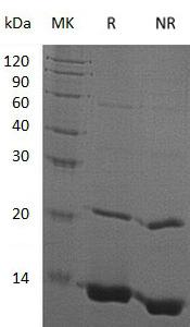 Human OASL/TRIP14 (His tag) recombinant protein