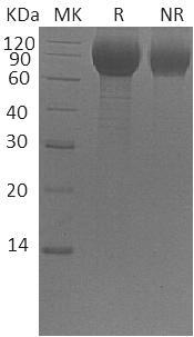 Human IFNAR1/IFNAR (His tag) recombinant protein