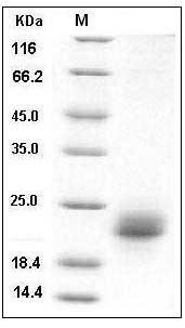 Human VEGF-C Protein (His Tag) SDS-PAGE