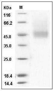 Human IL7RA / CD127 Protein (His Tag) SDS-PAGE