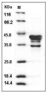 Human CAMK1 / CaMKI-alpha Protein SDS-PAGE