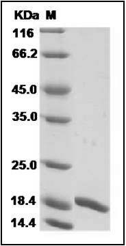 Human G-CSF / CSF3 Protein (isoform b) SDS-PAGE