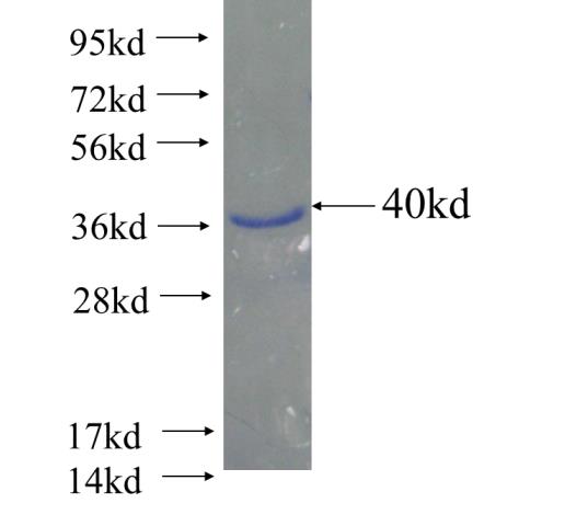 Recombinant human ALDH9A1 SDS-PAGE