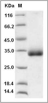 Rat CHODL / Chondrolectin Protein (His Tag) SDS-PAGE