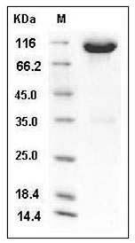 Mouse c-kit / CD117 Protein (Fc Tag) SDS-PAGE