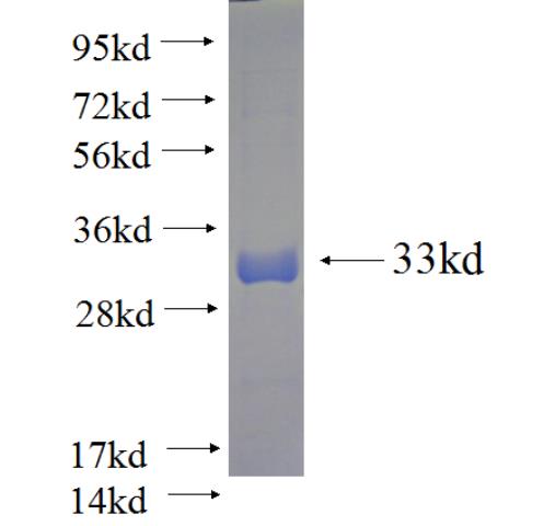 Recombinant human TRIM10 SDS-PAGE